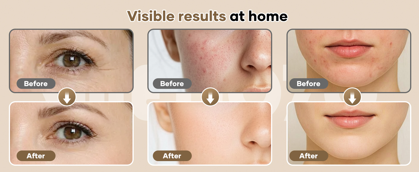 RB-061 visible results at home visual